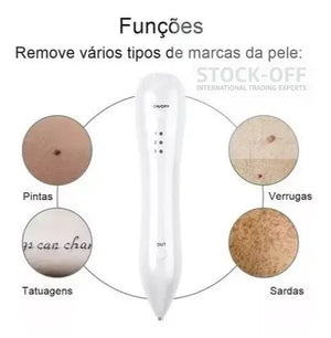 🔥 SUPER DEALS - Caneta Jato Plasma 3 Intensidades Tratamento Pele | Testado Porto™ | -75% 🇵🇹 Stock OFF